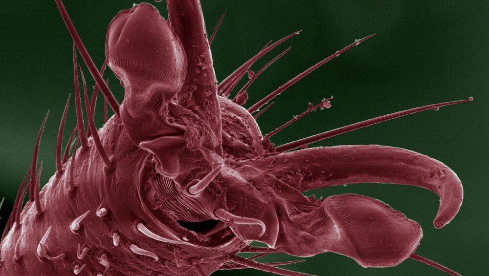 Demodex Artışını Tetikleyen Temel Faktörler Nelerdir?
