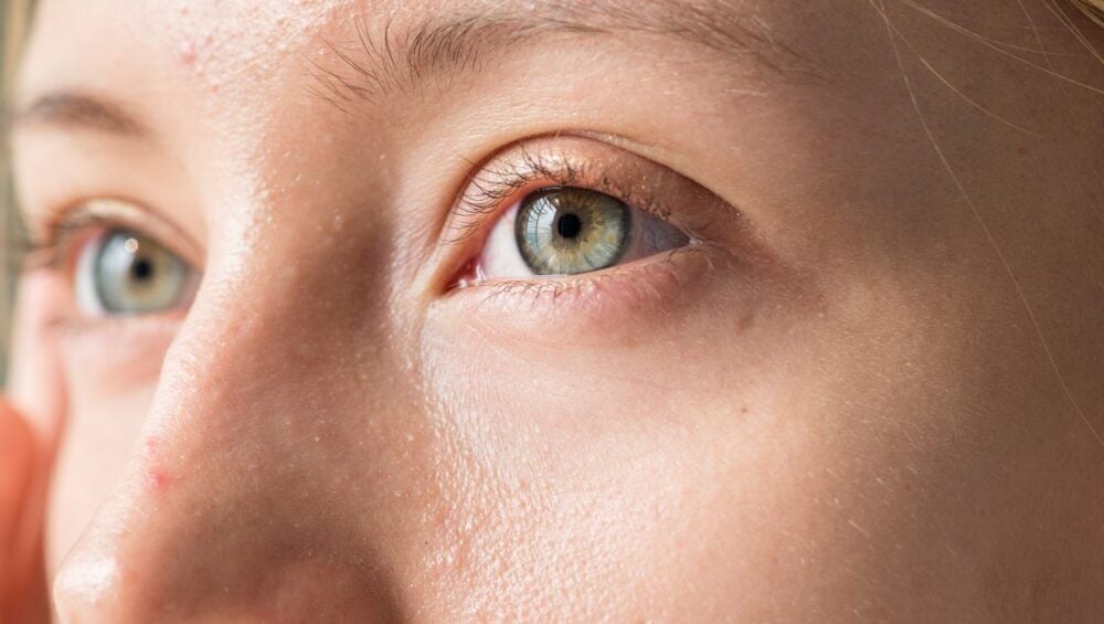 Demodex Göz Tedavisinde Özel Ürünlerin Nasıl Bir Etkisi Vardır?