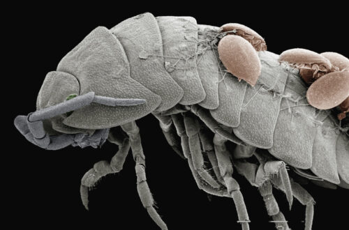 Demodex Hastalığına Sahip Olduğunuzu Nasıl Anlarsınız?