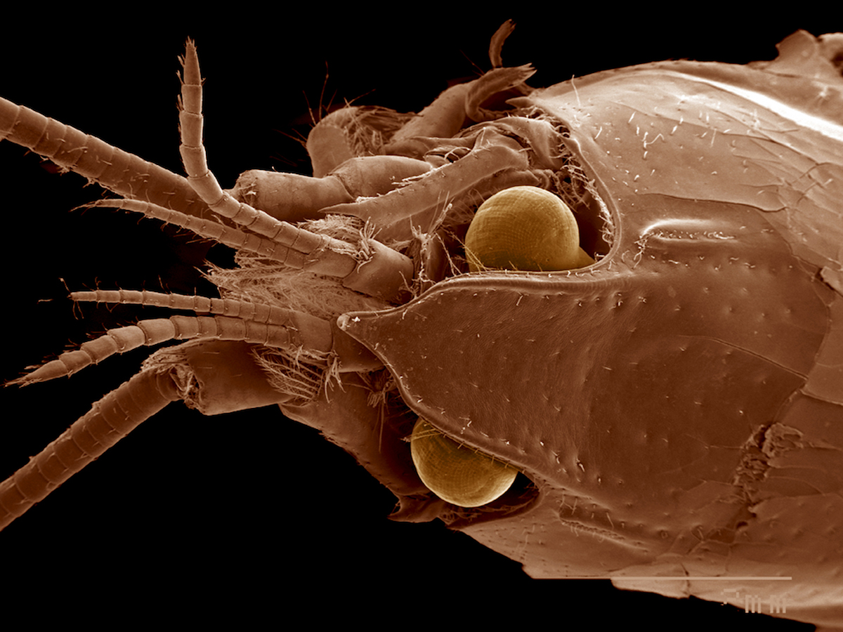 Demodex Akarlarının Sebep Olduğu Hastalıklar